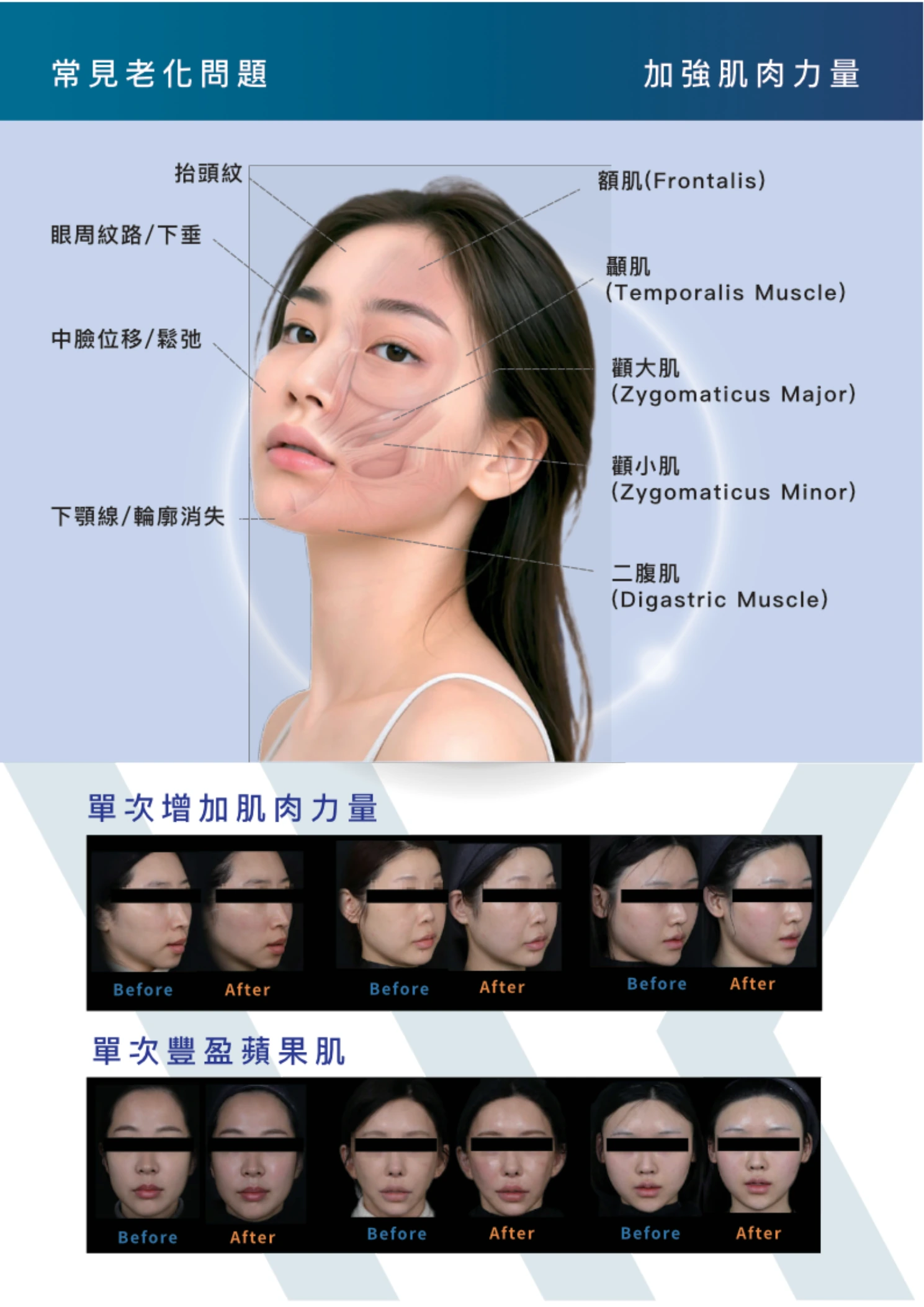 WINBACK 4 電子型錄第 4 頁